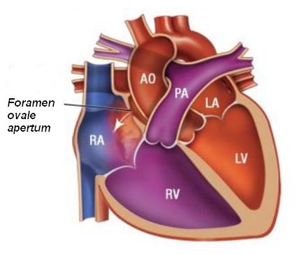 course of blood in the Patent formane ovale