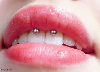 An example of a smiley piercing