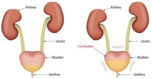 Urinary tract infection contributing to cloudy urine