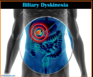 Biliary Dyskinesia 2