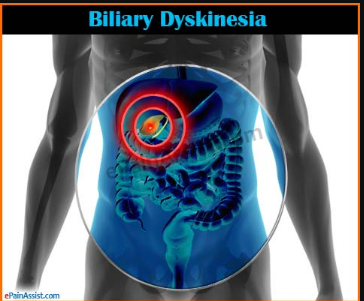 Biliary Dyskinesia Causes