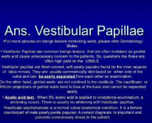 Vestibullar Papilliomatosis 4