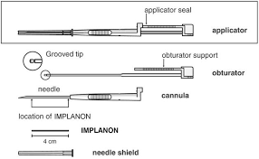 Nexplanon Implant Pictures 2