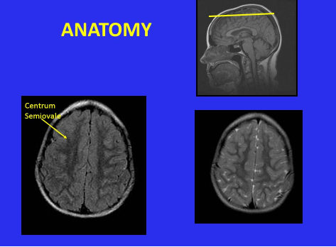 Centrum Semiovale Anatomy