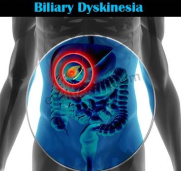 Biliary Dyskinesia images